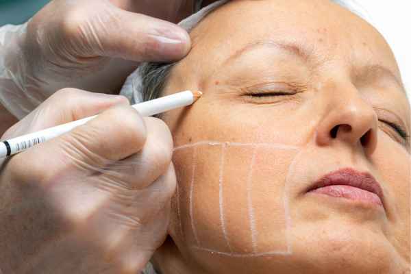 CryoPen: 5 Skin Concerns It May Be Used to Treat 4 What should you ask before having CryoPen treatment Rhyl?
