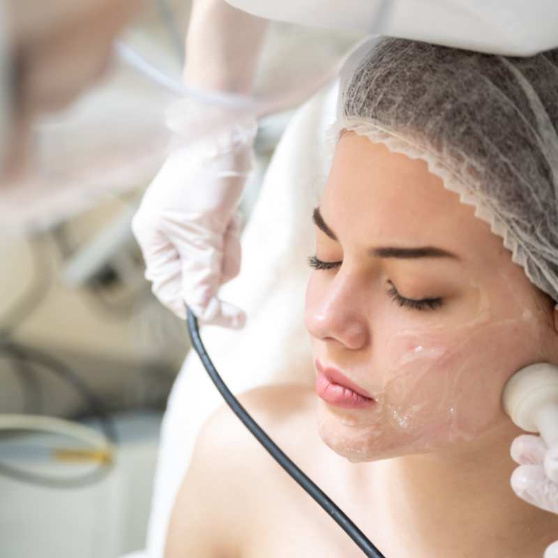 Why Do People Choose HIFU for a Non-Surgical Facelift? 5 What are the risks Rhyl?