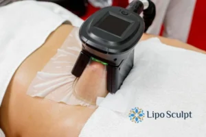 Does Fat Freezing At Home Work? 3 Fat freezing at home from Lipo Sculpt Rhyl